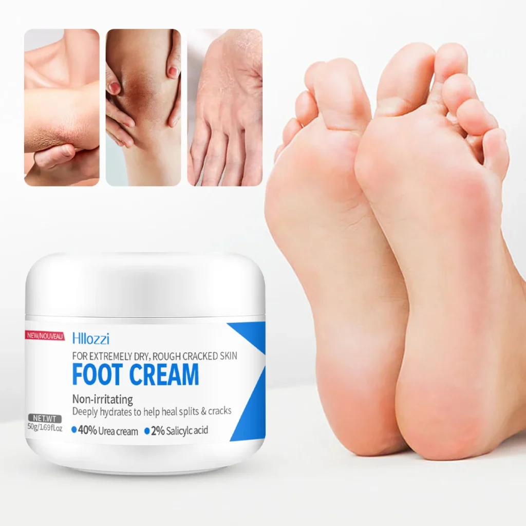 Hllozzi 40% Urea Foot Cream with 2% Salicylic Acid for Dry Cracked Skin 50g